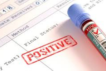 Фотография к новости: 4 случая заражения ВИЧ пенсионерами зарегистрировано в столице с начала года 