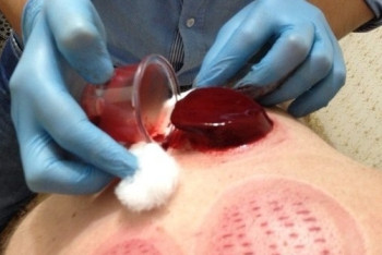 Фотография к новости: Незаконное кровопускание совершали жители Алматинской области: трое наказаны