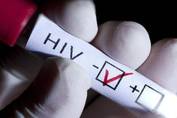 Фотография к новости: В Великобритании второй пациент в истории может излечиться от ВИЧ-инфекции