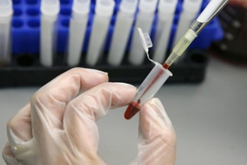 Фотография к новости: Почти вдвое вырос уровень заболевания гепатитом А за год среди казахстанцев