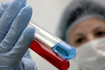 Фотография к новости: В Астане увеличилось количество ВИЧ-инфицированных 