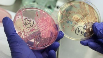 Фотография к новости: В Астане зарегистрирован очередной случай менингококковой инфекции 