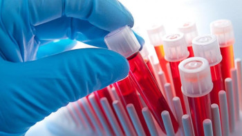 Фотография к новости: Увеличение пятилетной выживаемости до 60% прогнозируют гематологи Казахстана 