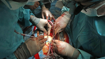 Фотография к новости: Полностью вживляемое искусственное сердце могут внедрить в Казахстане