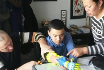 Фотография к новости: 3D-протезирование презентовали в Астане