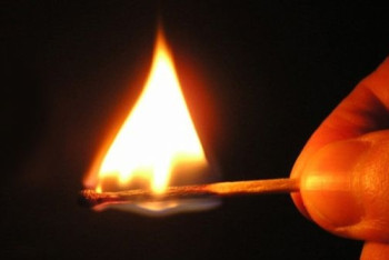 Фотография к новости: Детвора подожгла шестилетнего мальчика в Таразе