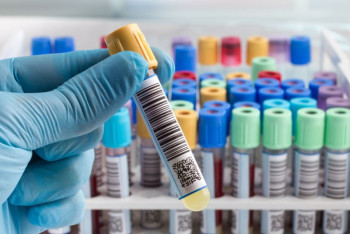 Фотография к новости: Коллекция штаммов особо опасных инфекций под надёжной защитой - глава научного центра в Алматы