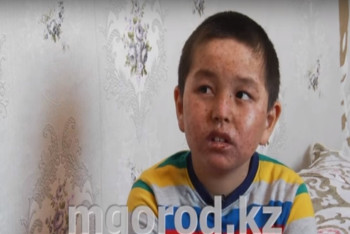 Фотография к новости: Из-за редкого заболевания двое братьев из ЗКО вынуждены жить ночью 