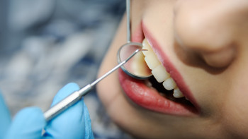 Фотография к новости: Ученые назвали смертельную опасность проблем с зубами