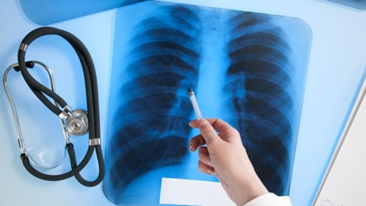  Из открытого источника 