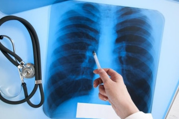 Фотография к новости: Около 900 человек ежегодно болеют туберкулезом в Астане