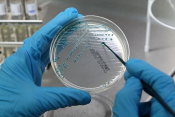 Фотография к новости: Кишечная палочка обнаружена в некоторых продуктах в Карагандинской области  