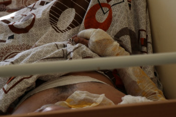 Фотография к новости: Как рабочие спасались от пожара на Карабатане, рассказали выжившие