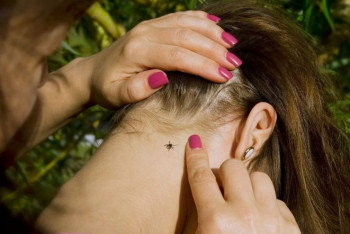 Фотография к новости: Больше 100 человек пожаловались на укусы клещей в Алматы