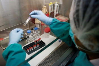 Фотография к новости: Возможный источник массового заражения гепатитом А в ВКО назвал Минздрав