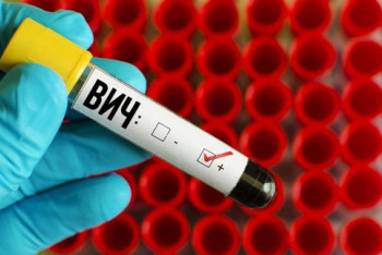 Фотография к новости: ВИЧ нашли у 80-летней жительницы Кызылорды