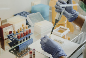 Фотография к новости: Бесплатную генетическую диагностику рака начнут проводить в РК в 2019 году