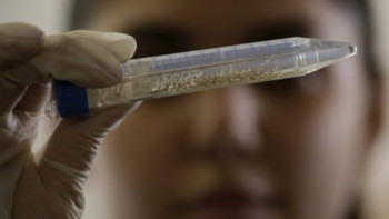 Фотография к новости: Казахстанцы стали реже болеть дизентерией – Минздрав