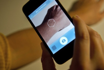 Фотография к новости: С ноября 2017 года медсестры смогут оказывать первую помощь с помощью смартфона 