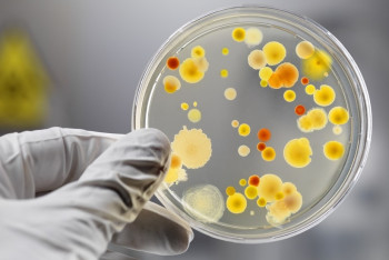 Фотография к новости: У четверых отравившихся на поминках в Бурабае подтвержден сальмонеллез