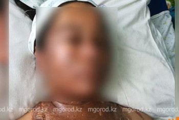 Фотография к новости: Клиент опрокинул казан с кипящим маслом на кассира столовой в Мангистау