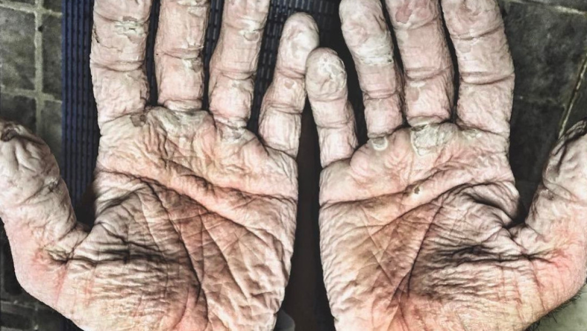  из соцсетей