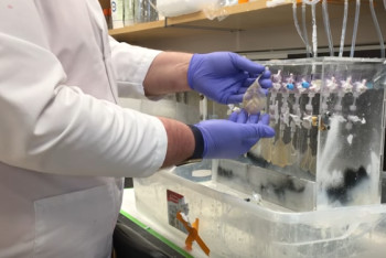 Фотография к новости: Британские ученые вырастили сердечную мышечную ткань из шпината