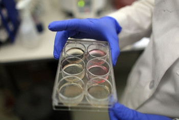 Фотография к новости: В Японии впервые в мире пациенту пересадили iPS-клетки другого человека