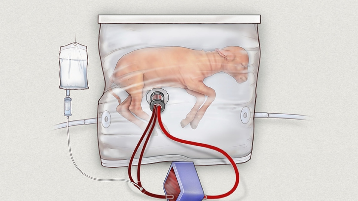  © Children’s Hospital of Philadelphia via AP  