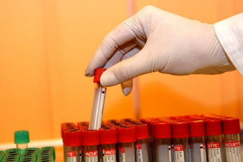 Фотография к новости: Казахстанских легкоатлетов среди заразившихся вирусной инфекцией в Лондоне нет