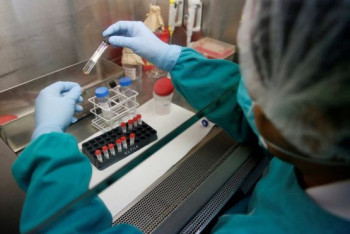 Фотография к новости: Британские ученые совершили прорыв в диагностике туберкулеза