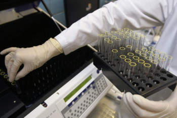 Фотография к новости: Для восстановления работы антидопинговой лаборатории в Алматы нет средств – МКС РК