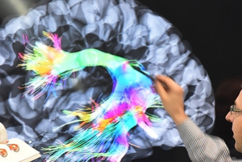 Фотография к новости: Американские ученые нашли способ стирать плохие воспоминания