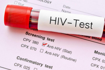 Фотография к новости: Почему Минздрав запрещает частным лабораториям проводить анализы на ВИЧ 