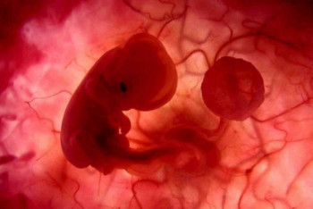 Фотография к новости: Япония впервые одобрила эксперименты с эмбрионами человека и животных