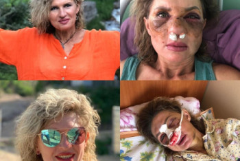 Фотография к новости: Неизвестный напал с кастетом на женщину-психолога в Алматы 