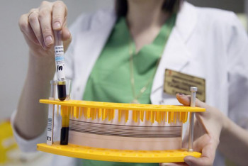 Фотография к новости: Онколог назвала 12 основных симптомов рака