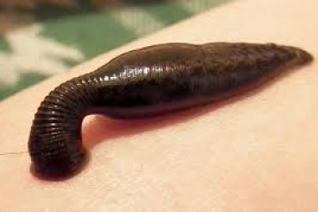 Фотография к новости: Мальчик в Китае в течение 10 дней жил с пиявкой в горле