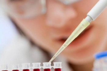 Фотография к новости: Заболеваемость вирусным гепатитом "С" в РК снизилась почти в три раза