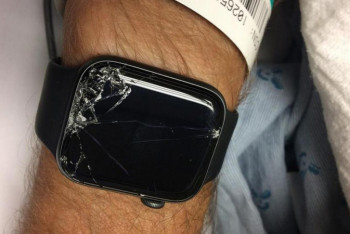 Фотография к новости: Умные часы спасли жизнь велосипедисту в США 