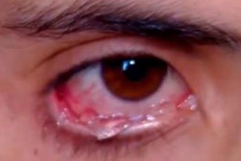 Фотография к новости: В Армении живёт девушка, которая плачет хрустальными слезами