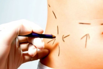 Фотография к новости: Дело пластического хирурга в Алматы: адвокат погибшей пациентки выступил с заявлением