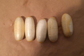 Фотография к новости: Казахстанец пытался провезти в желудке 42 капсулы с кокаином 