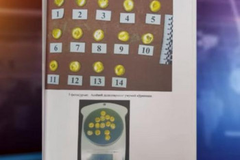 Фотография к новости: Жителя Ташкента осудили за попытку вылететь в Индию с золотом в желудке