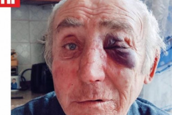 Фотография к новости: Избитый в гаражном обществе Костаная пенсионер отказался примиряться со своими обидчиком