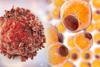 Фотография к новости: Состарившиеся раковые клетки едят молодых