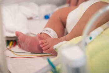 Фотография к новости: Новорожденный лишился носа в перинатальном центре в Актау