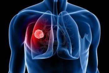 Фотография к новости: В 15 раз снизилась смертность от туберкулёза в Акмолинской области