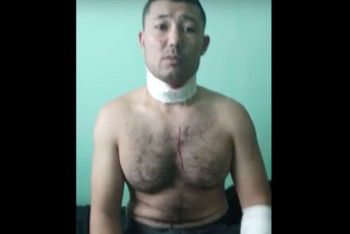 Фотография к новости: Осужденные с порезанным горлом жалуются на беспредел в колонии поселка Заречного в Алматинской области