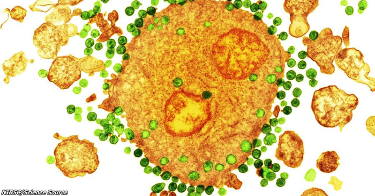  NIBSC/Science Source 